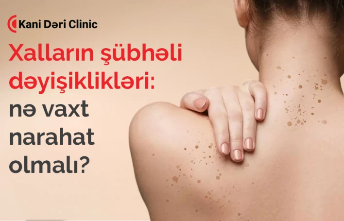 Xalların şübhəli dəyişiklikləri: nə vaxt narahat olmalı?