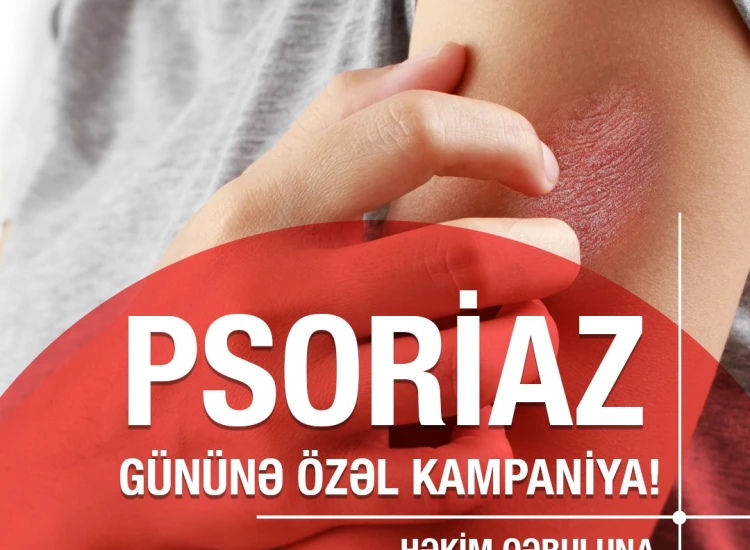 Psoriaz Gününə özəl kampaniya! Həkim qəbuluna – 50% endirim!