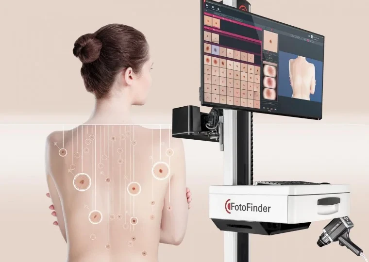 FotoFinder bodystudio