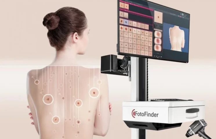 FotoFinder